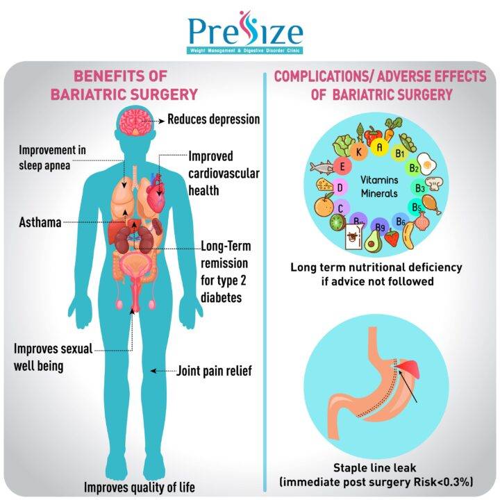 bariatric surgery in pune