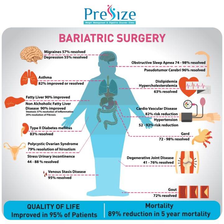 bariatric surgery in pune