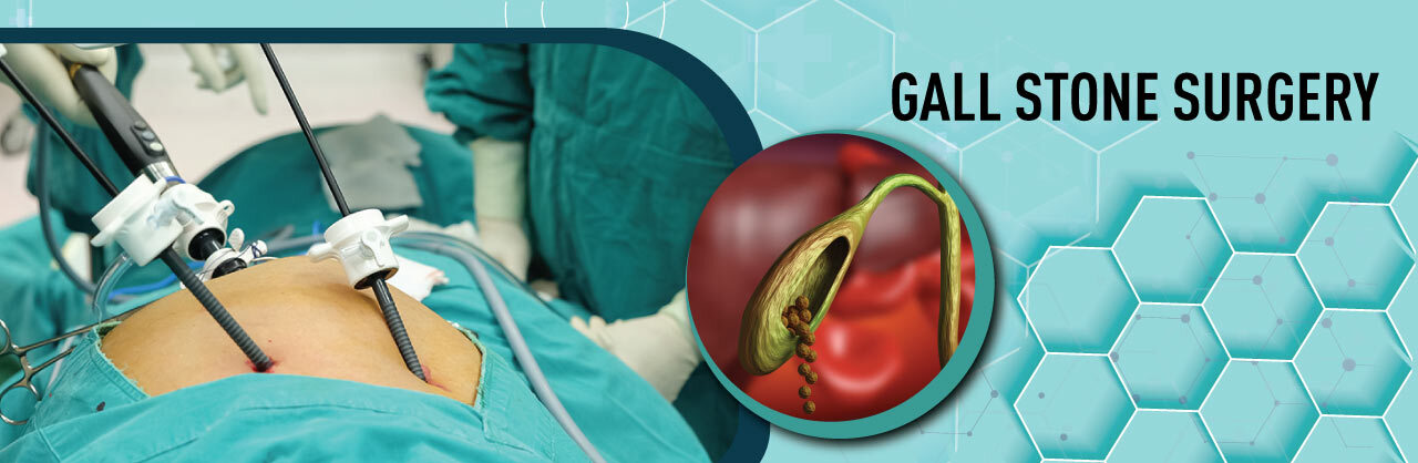 Gallstone treatment in pune