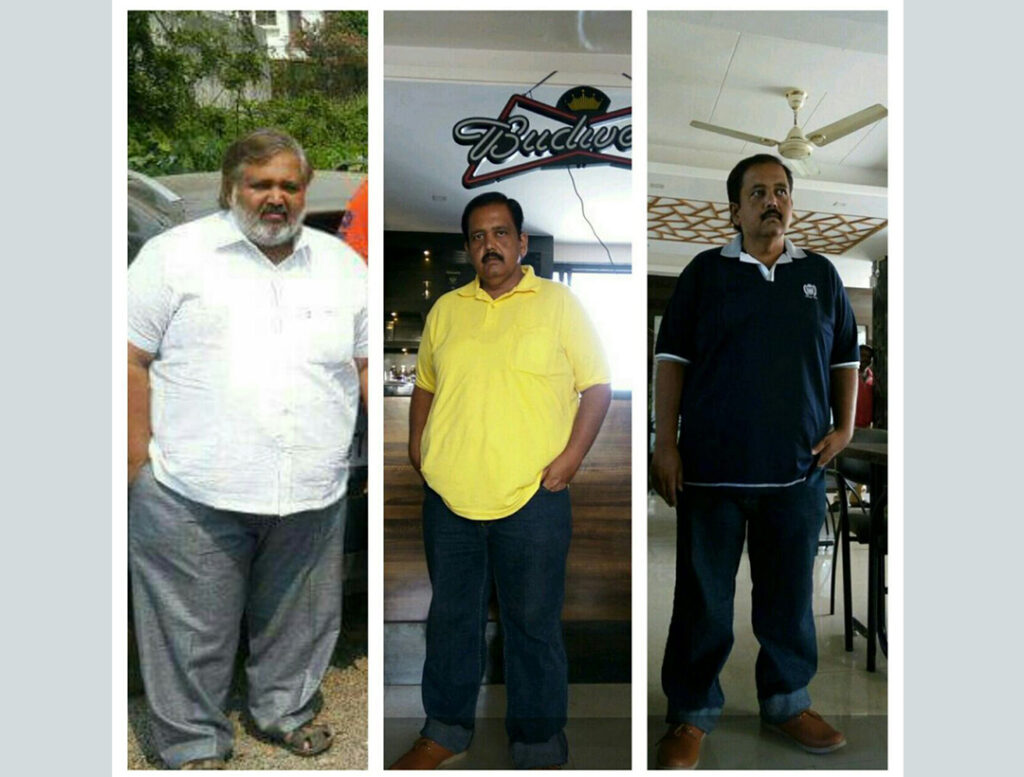 Weight loss Patient2