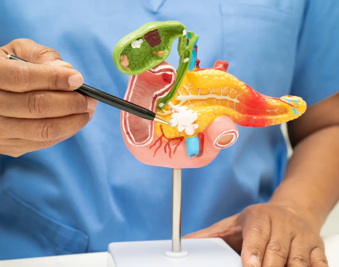 difference between gallstones and kidney stones