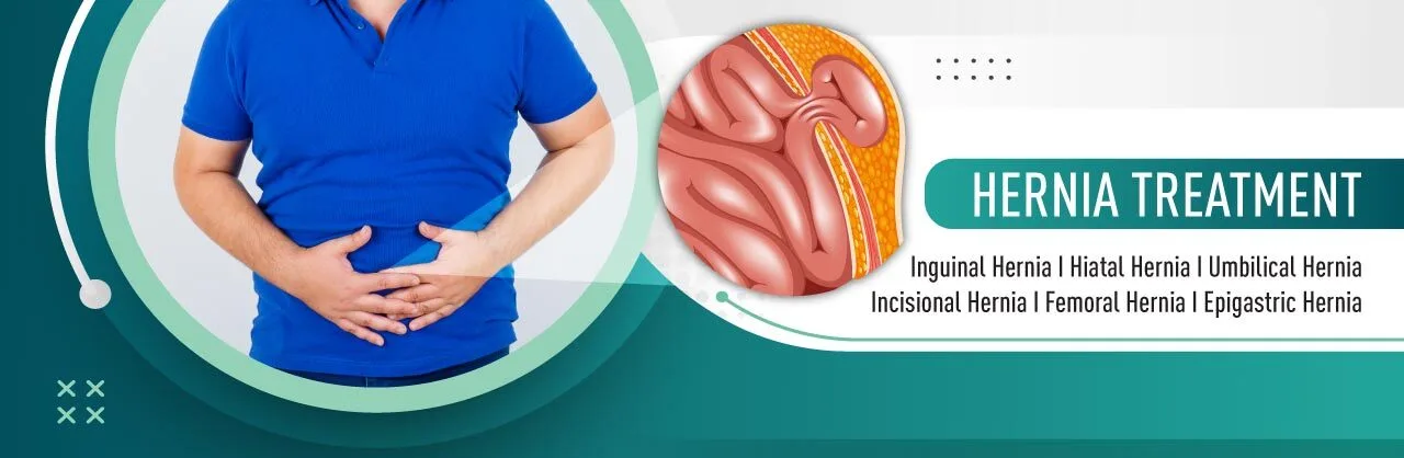Hernia treatment banner with man holding abdomen and medical illustration of hernia