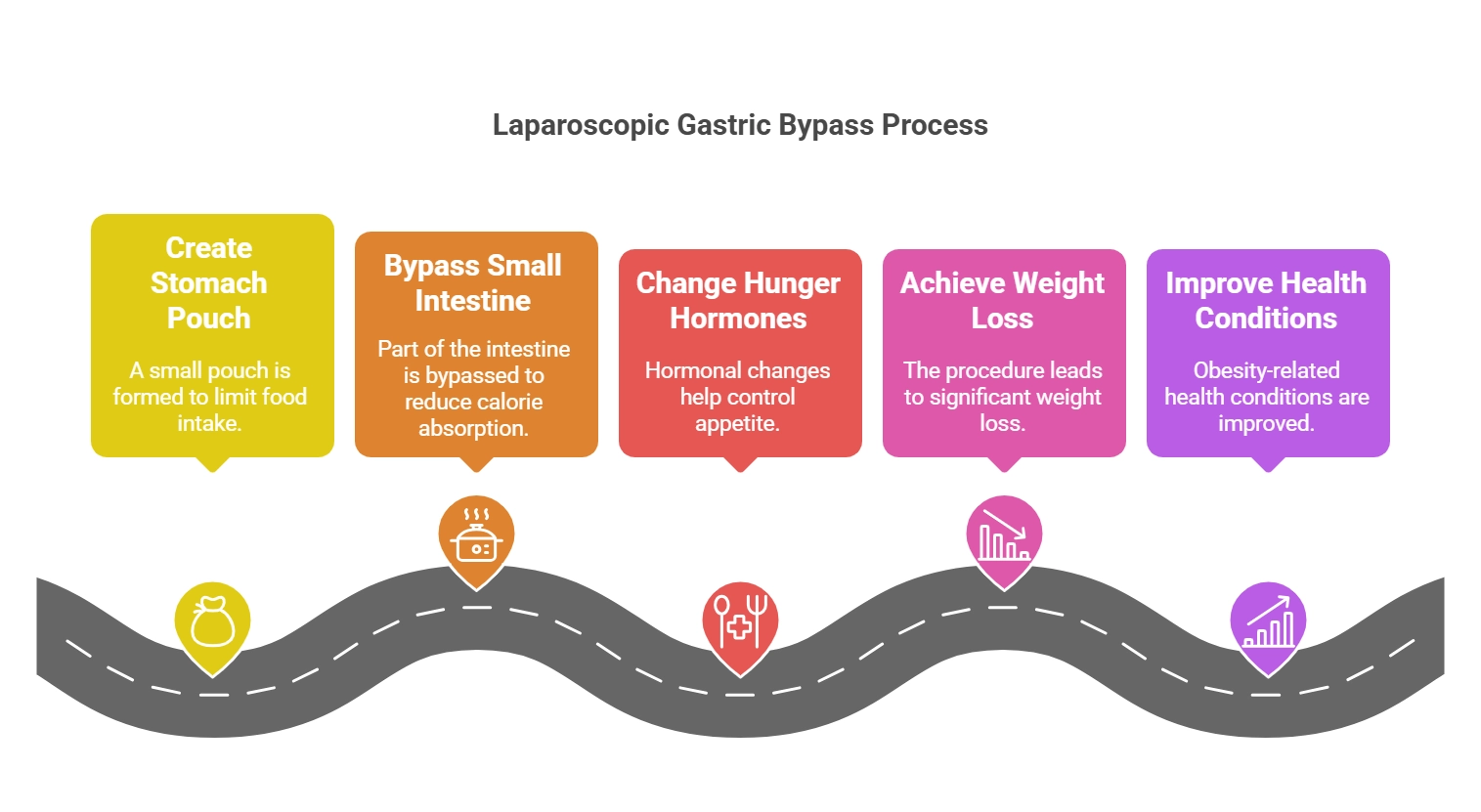Infographic showing laparoscopic gastric bypass process steps