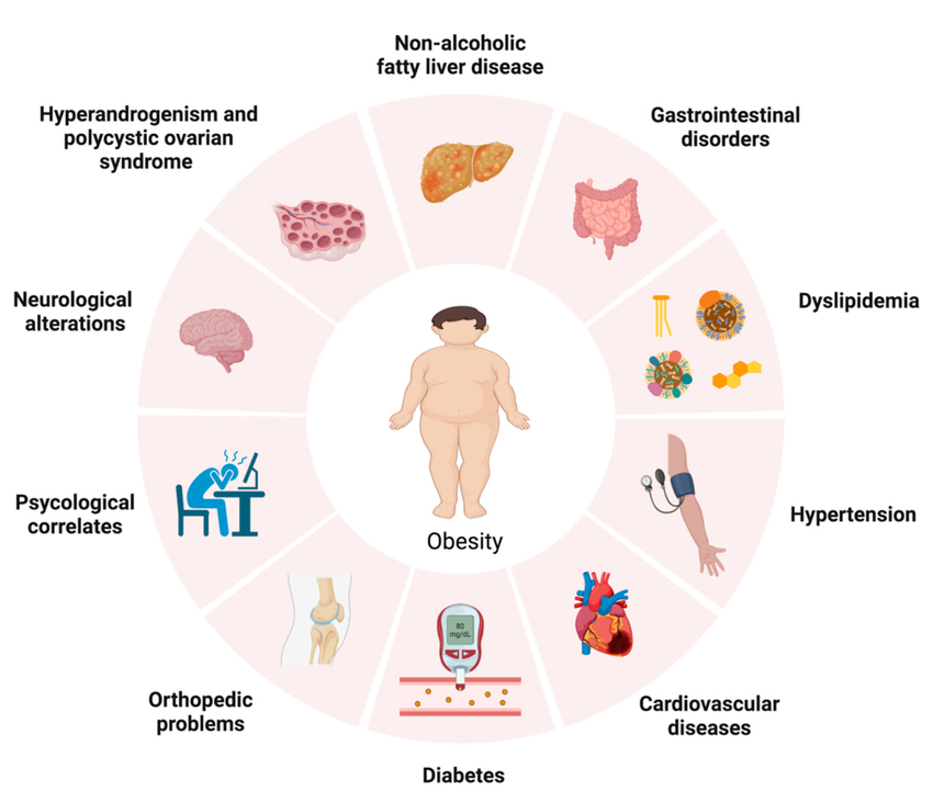 Infographic showing major health complications linked to obesity